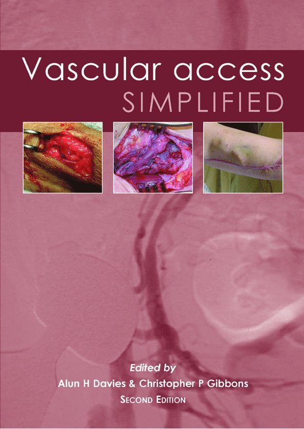 Vascular Access Simplified; second edition