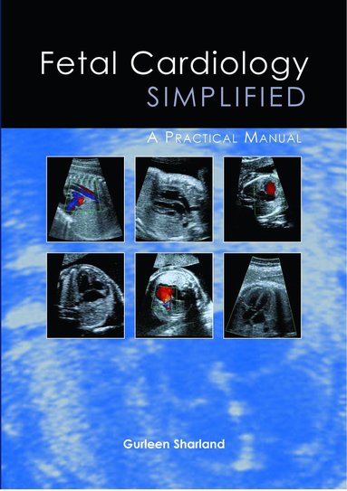 bokomslag Fetal Cardiology Simplified