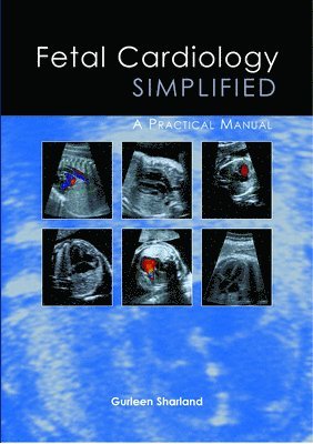 Fetal Cardiology Simplified 1