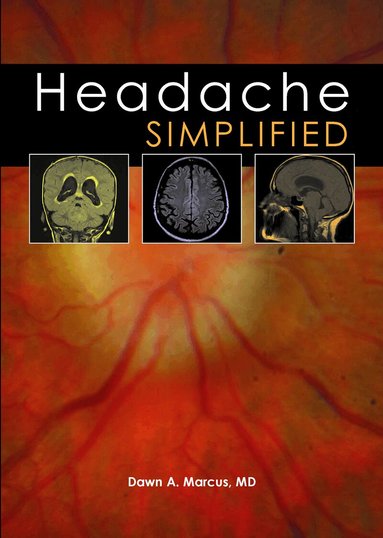 Dawn A. Marcus - Headache Simplified, Häftad