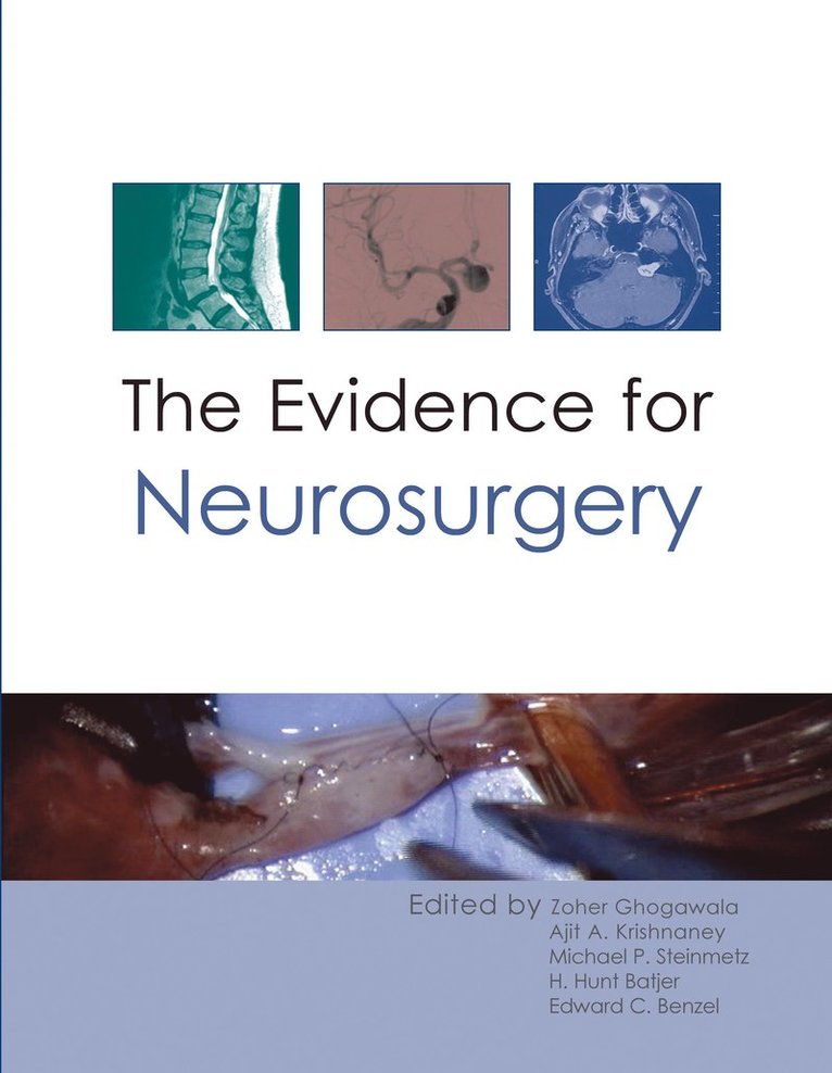 Zoher Ghogawala, Ajit A. Krishnaney, Michael P Steinmetz, H. Hunt Batjer, Edward C. Benzel, Professor Zoher Ghogawala, Dr Ajit A. Krishnaney, Dr Michael P Steinmetz, Professor H. Hunt Batjer, Dr Edward C. Benzel, Ajit A Krishnaney, H Hunt Batjer, Edward C Benzel - Evidence for Neurosurgery, Inbunden