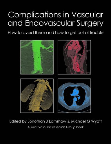Jonothan J Earnshaw, Michael G Wyatt - Complications in Vascular and Endovascular Surgery, Inbunden