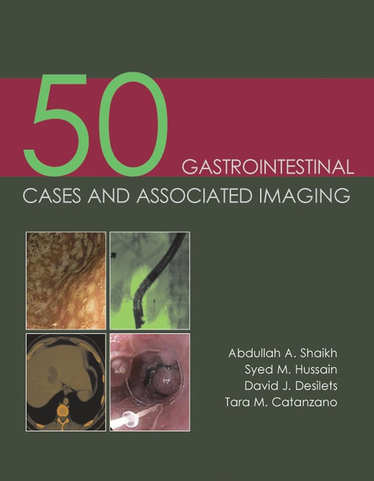 Abdullah A. Shaikh, Syed M. Hussain, David J Desilets, Tara M. Catanzano, Dr Abdullah A. Shaikh, Dr Syed M. Hussain, Dr David J Desilets, Dr Tara M. Catanzano, Abdullah A Shaikh, Syed M Hussain, Tara M Catanzano - 50 Gastrointestinal Cases and Associated Imaging, Häftad