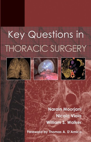 Narain Moorjani, Nicola Viola, William S Walker - Key Questions in Thoracic Surgery, Häftad