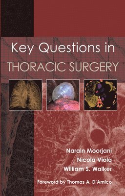 Key Questions in Thoracic Surgery 1