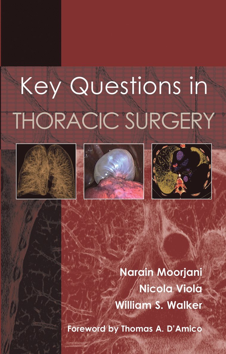 Narain Moorjani, Nicola Viola, William S Walker, Dr Narain Moorjani, Dr Nicola Viola, Dr William S Walker, William S. Walker - Key Questions in Thoracic Surgery, Häftad