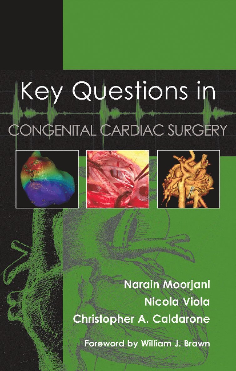 Narain Moorjani, Nicola Viola, Christopher Caldarone, Narain Moorjani, Nicola Viola, Christopher Caldarone - Key Questions in Congenital Cardiac Surgery, Häftad