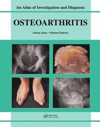 bokomslag Oesteoarthritis
