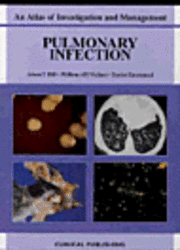 bokomslag Pulmonary Infection