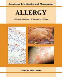 bokomslag Allergy