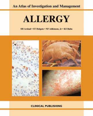 bokomslag Allergy