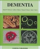 bokomslag Dementia:   An Atlas of Investigation and Diagnosis