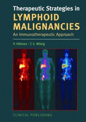 bokomslag Therapeutic Strategies in Lymphoid Malignancy: An Immunotherapeutic Approach