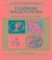 bokomslag Lymphoid Malignancies: v. 1