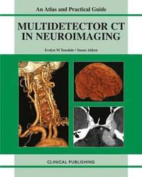 bokomslag Multidetector CT in Neuroimaging
