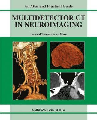 Multidetector CT in Neuroimaging 1