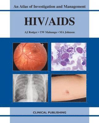 bokomslag HIV/AIDS