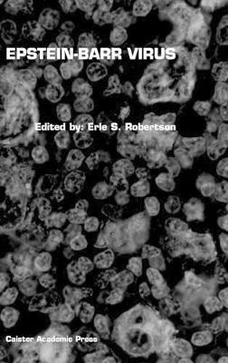 Erle S. Robertson - Epstein-Barr Virus, Inbunden