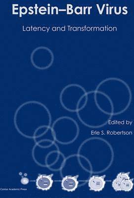 Erle S. Robertson - Epstein-Barr Virus, Inbunden