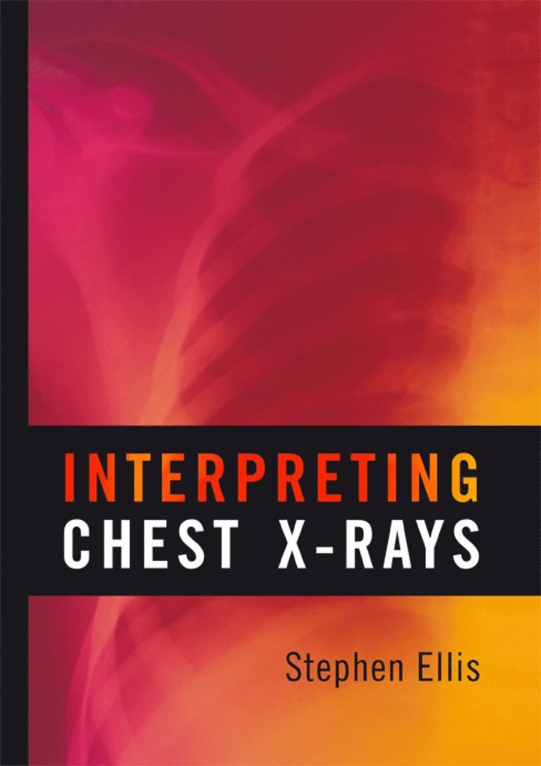 Stephen Ellis - Interpreting Chest X-Rays, Häftad