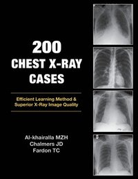 bokomslag 200 Chest X-Ray Cases