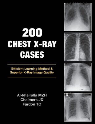 200 Chest X-Ray Cases 1