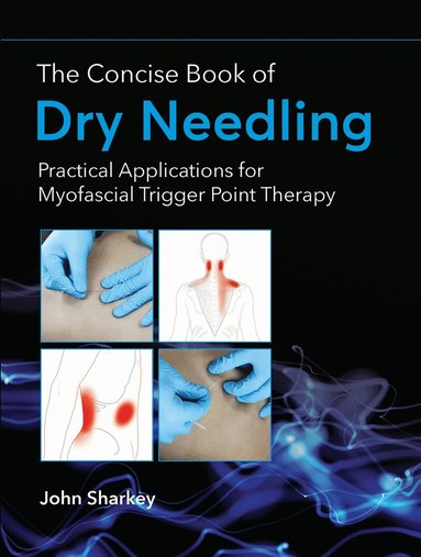 John Sharkey - Concise Book of Dry Needling, Häftad