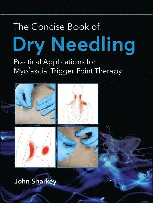 bokomslag Concise Book of Dry Needling