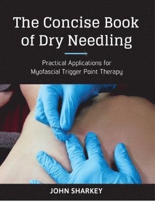The Concise Book of Dry Needling 1