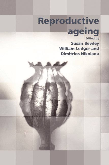 Reproductive Ageing 1