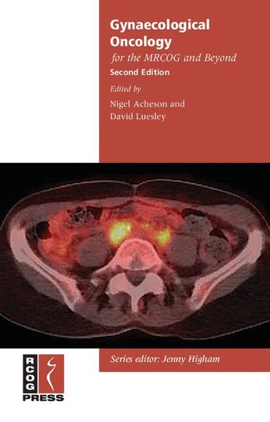 Nigel Acheson, David Luesley - Gynaecological Oncology for the MRCOG and Beyond, Häftad