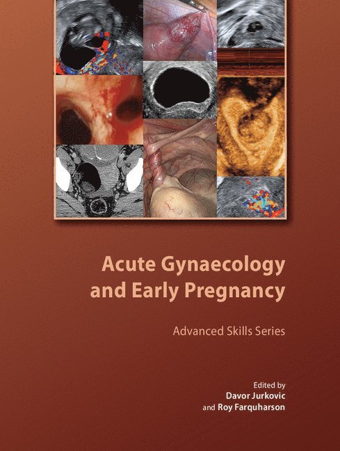 Acute Gynaecology and Early Pregnancy 1