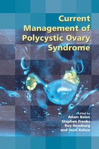 bokomslag Current Management of Polycystic Ovary Syndrome