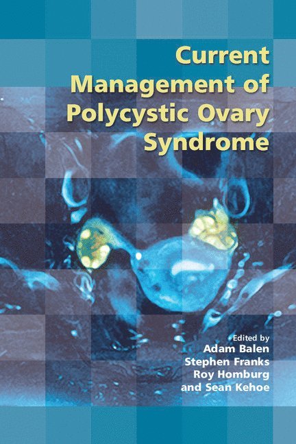 Current Management of Polycystic Ovary Syndrome 1