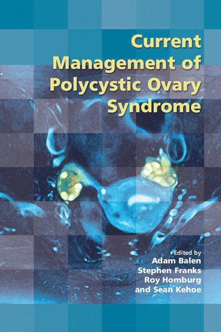 Adam (University of Leeds) Balen, Stephen Franks, Roy Homburg, Sean Kehoe, Adam Balen - Current Management of Polycystic Ovary Syndrome, Häftad