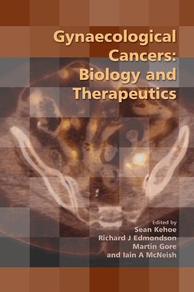 Sean Kehoe, Richard J. Edmondson, Martin Gore, Iain A. McNeish - Gynaecological Cancers, Häftad
