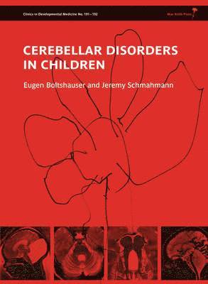 Cerebellar Disorders in Children 1