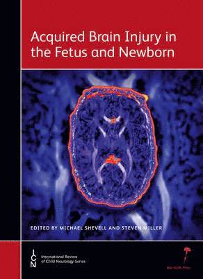 Acquired Brain Injury in the Fetus and Newborn 1
