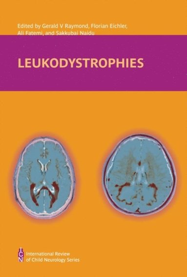 bokomslag Leukodystrophies