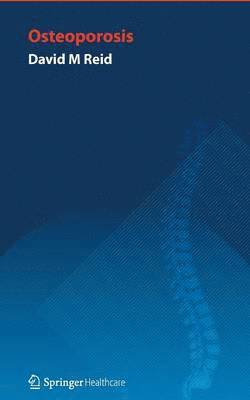 David Reid - Handbook of Osteoporosis, Häftad