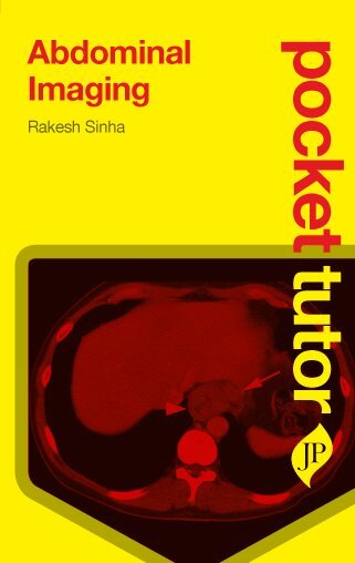 Rakesh Sinha - Pocket Tutor Abdominal Imaging, Häftad
