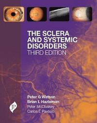 bokomslag The Sclera and Systemic Disorders