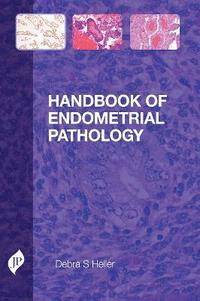 bokomslag Handbook of Endometrial Pathology