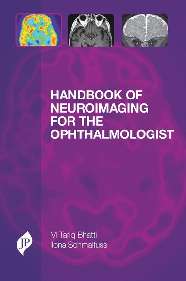 bokomslag Handbook of Neuroimaging for the Ophthalmologist