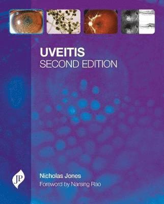 bokomslag Uveitis