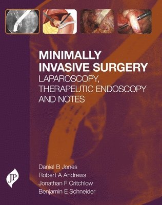 bokomslag Minimally Invasive Surgery