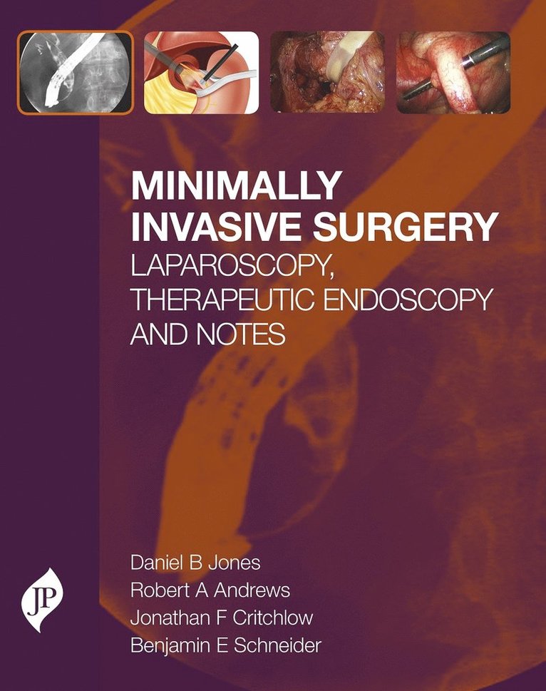 Daniel  B Jones, Robert Andrews, Jonathan F Critchlow, Benjamin E Schneider - Minimally Invasive Surgery, Inbunden