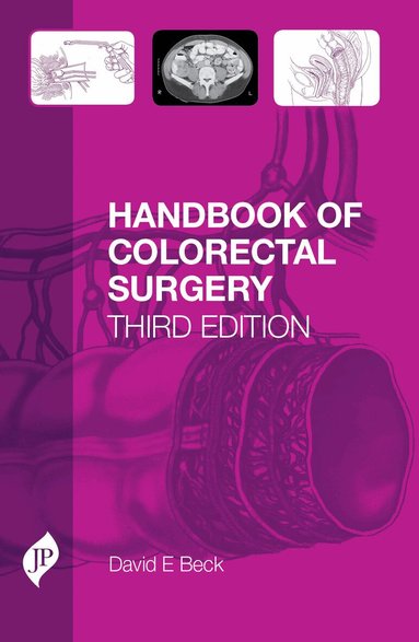 David Beck - Handbook of Colorectal Surgery, Inbunden