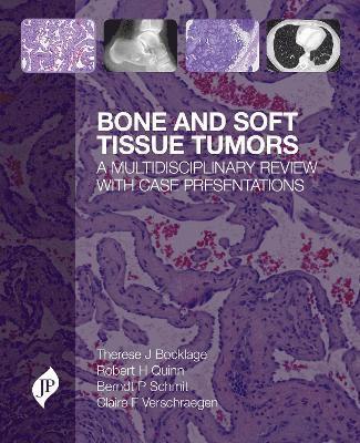 Bone and Soft Tissue Tumors 1
