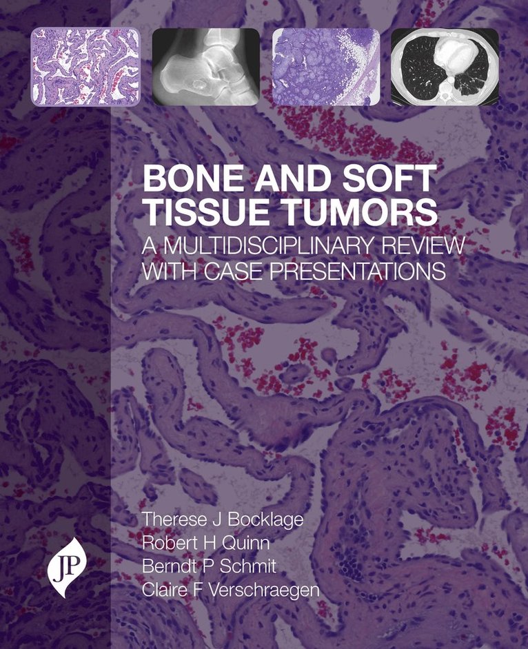 Therese J Bocklage, Robert Quinn, Berndt Schmit, Claire Verschraegen - Bone and Soft Tissue Tumors, Inbunden